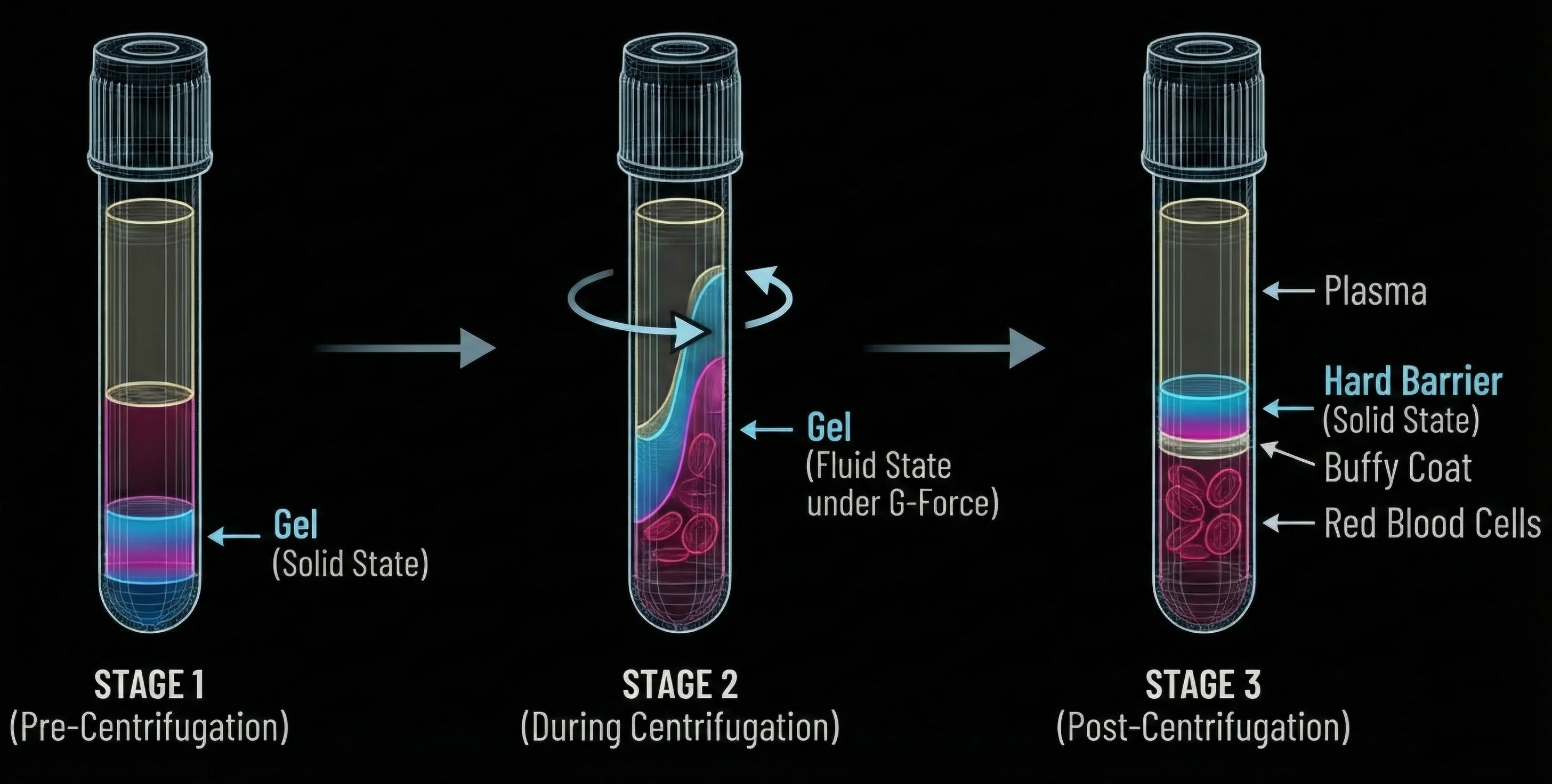 Tubo Etapa 1 - Gel Sólido